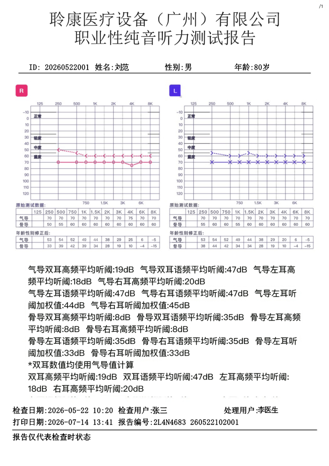聆康纯音听力计｜职业健康检查/职业病诊断核心优势(图3)